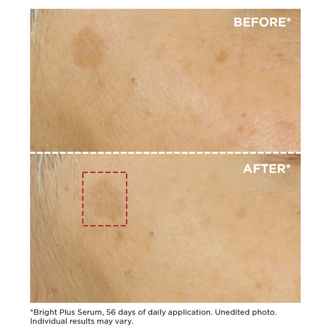 Bright Plus Face Brightening Dark Spot Serum