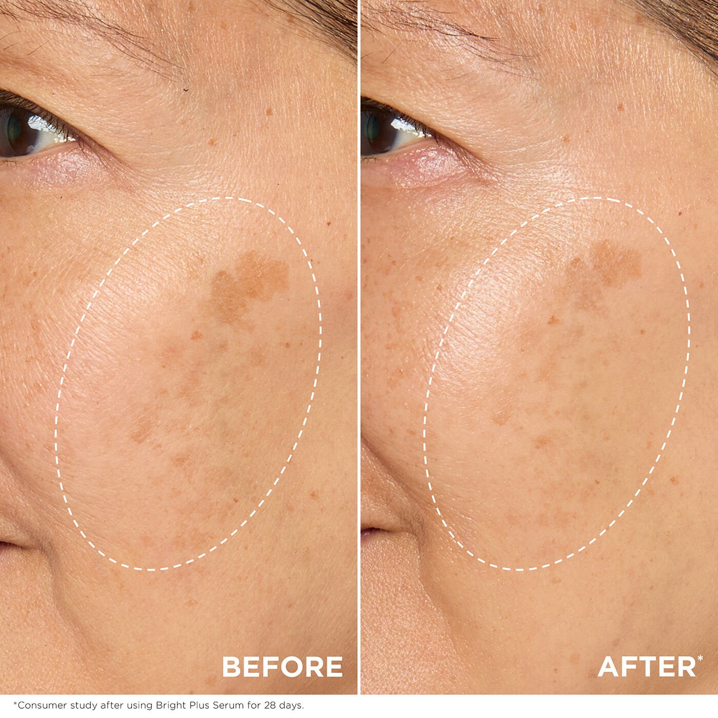 Bright Plus [Advanced] Serum | CLARINS®