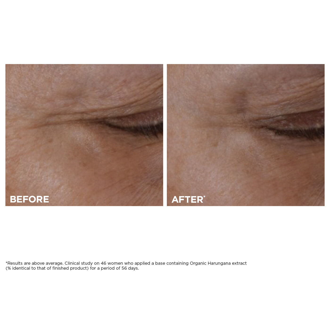 Total Eye Lift: Firming Under-Eye Cream for Wrinkles | CLARINS®